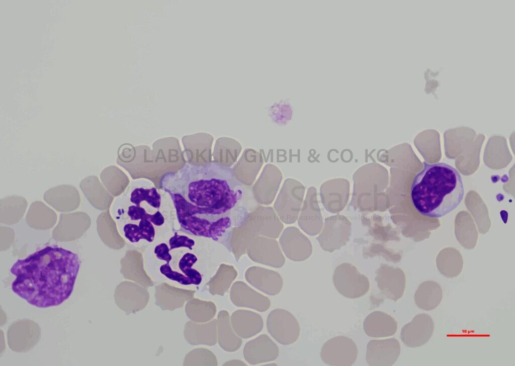 Anaplasma phagocytophilum – Vector borne